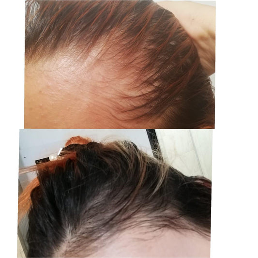 KIT RESCATE TOTAL PARA EL CRECIMIENTO Y LA RESTAURACION